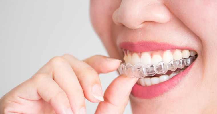 Straighten Your Smile with Clear Aligner Treatment 